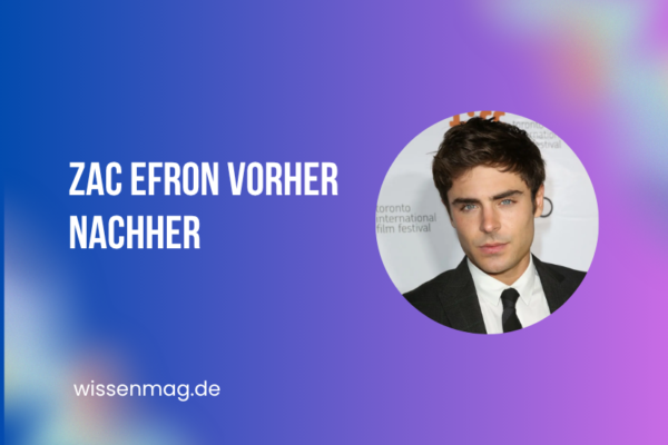 zac efron vorher nachher